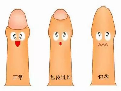 常见的男性疾病怎么治疗？